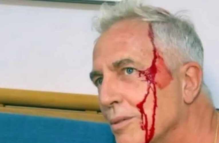 Marley se accidentó en Tailandia y terminó cubierto de sangre